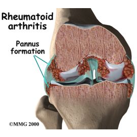 Popular Package - 90 Days