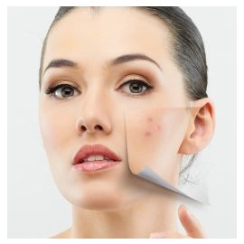 Anti Pimples Kit - herbal medicines + gel + soap + pack